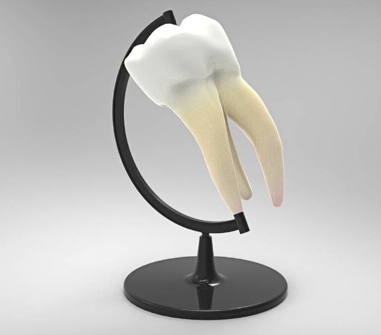 Ruszający się stały ząb. Czy można go uratować? 10 ruszajacy sie zab